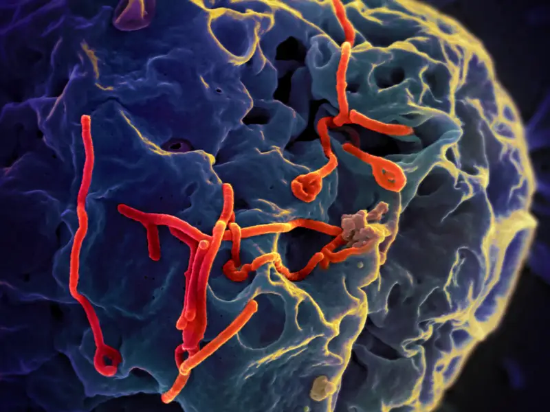 virus mematikan ebola