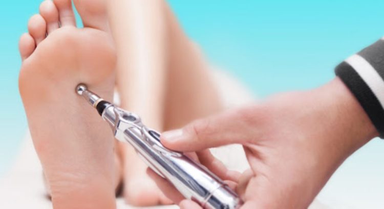 akupuntur tanpa jarum