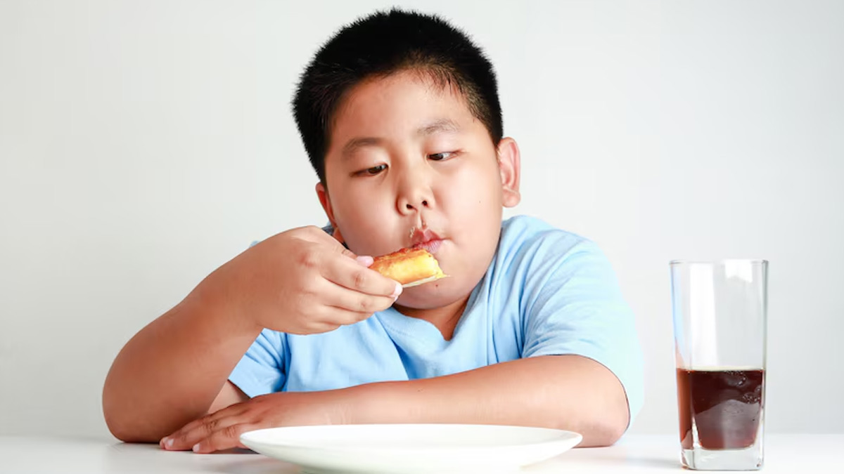 obesitas pada anak